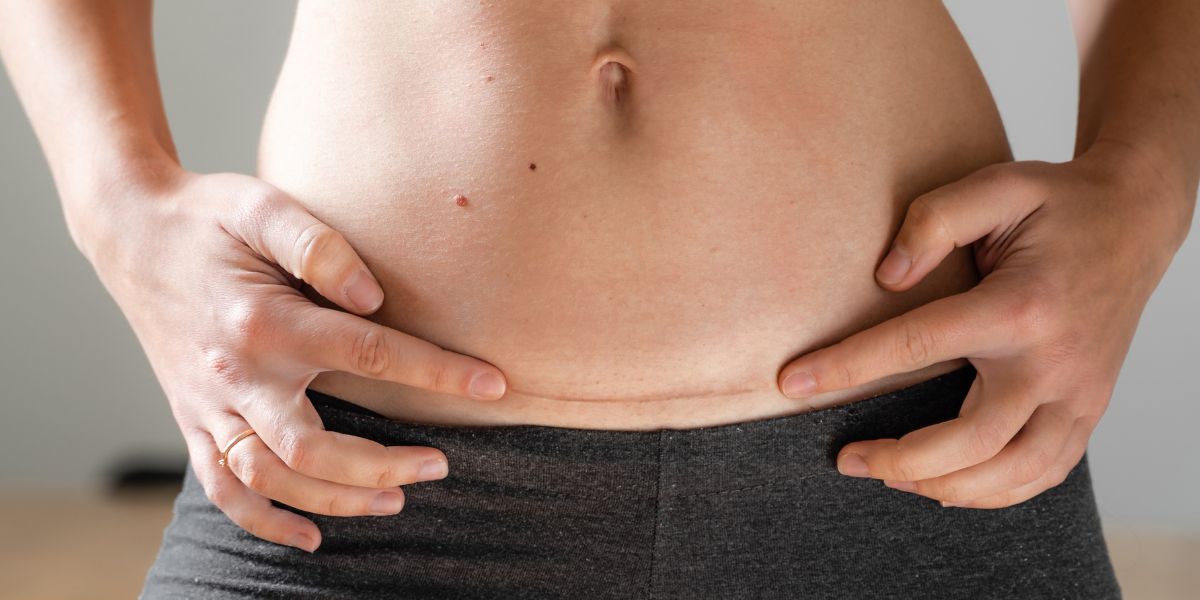Comment perdre du poids après une grossesse ? 